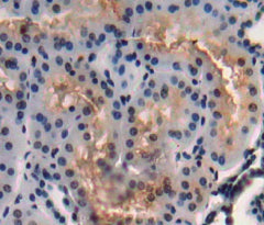 Amy1 Associated Protein Expressed In Testis (AAT1) Polyclonal Antibody - image 3