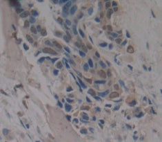 RNA Binding Motif Protein 20 (RBM20) Polyclonal Antibody - image 4