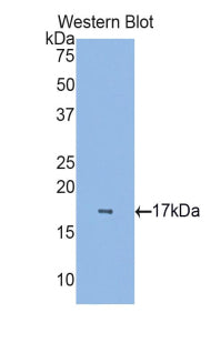 Western Blot; Sample: Human Serum; Primary Ab: 1μg/ml Rabbit Anti-Porcine RBP7 Antibody; Second Ab: 0.2µg/mL HRP-Linked Caprine Anti-Rabbit IgG Polyclonal Antibody;