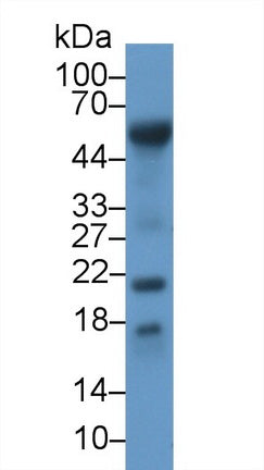 DAB staining on IHC-P; Samples: Porcine Kidney Tissue;  Primary Ab: 10µg/ml Rabbit Anti-Porcine RBP7 Antibody Second Ab: 2µg/mL HRP-Linked Caprine Anti-Rabbit IgG Polyclonal Antibody