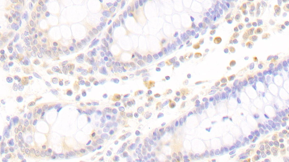 DAB staining on fromalin fixed paraffin- embedded Kidney tissue)