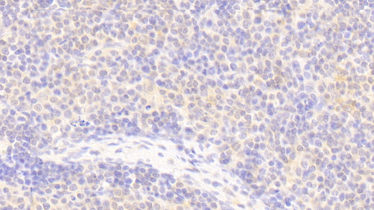 Amyloid Beta Precursor Protein Binding B1 Interacting Protein (APBB1IP) Polyclonal Antibody - image 4