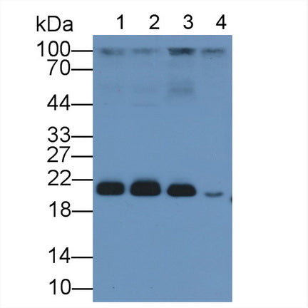 Ras Related C3 Botulinum Toxin Substrate 1 (Rac1) Polyclonal Antibody - image 3