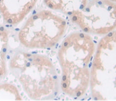 Ras Related C3 Botulinum Toxin Substrate 1 (Rac1) Polyclonal Antibody - image 4