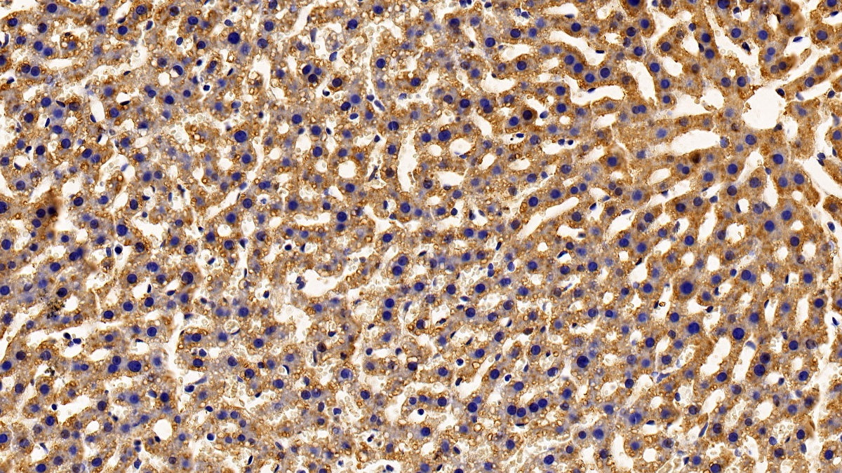 TNFRSF1A Associated Via Death Domain Protein (TRADD) Polyclonal Antibody - image 3