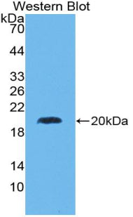 Suppressor Of Ty 6 Homolog (SUPT6H) Polyclonal Antibody - image 2