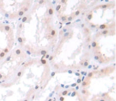Suppressor Of Ty 6 Homolog (SUPT6H) Polyclonal Antibody - image 3