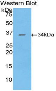 Salt Inducible Kinase 2 (SIK2) Polyclonal Antibody - image 2
