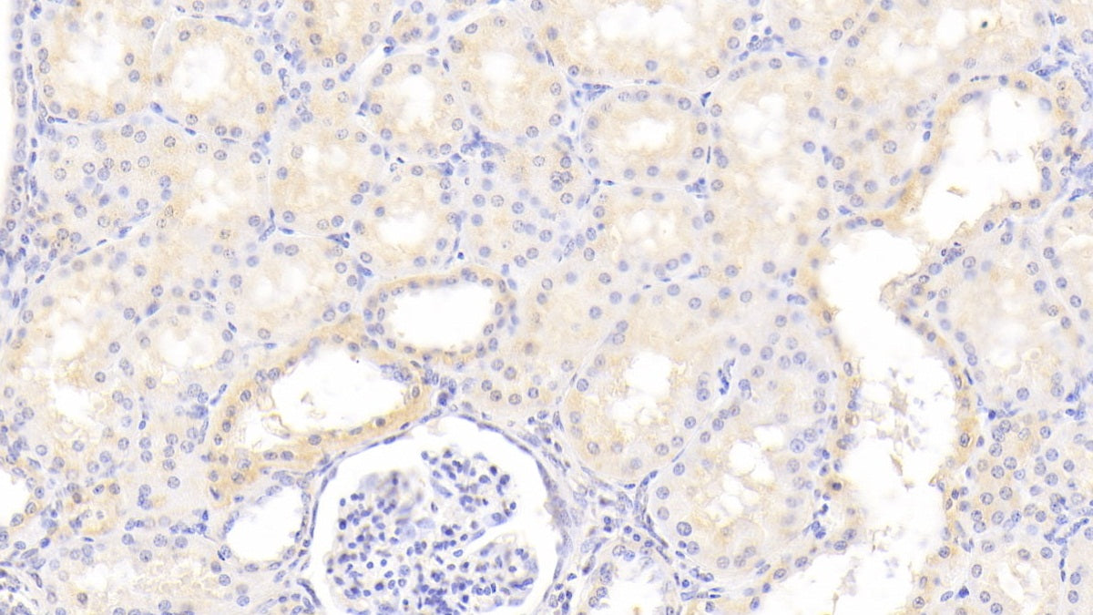 Salt Inducible Kinase 2 (SIK2) Polyclonal Antibody - image 3