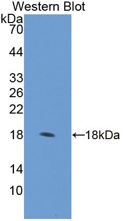 RCC1 And BTB Domain Containing Protein 2 (RCBTB2) Polyclonal Antibody - image 2