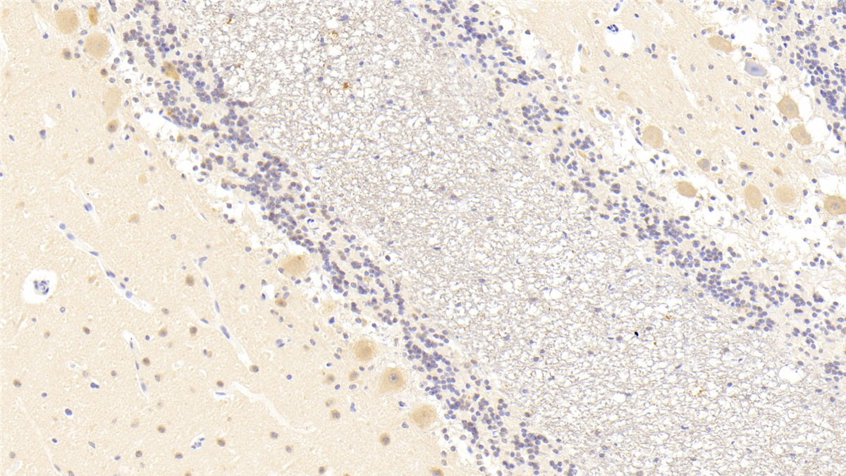 DABstainingonIHC-P.Samples:HumanTissue)