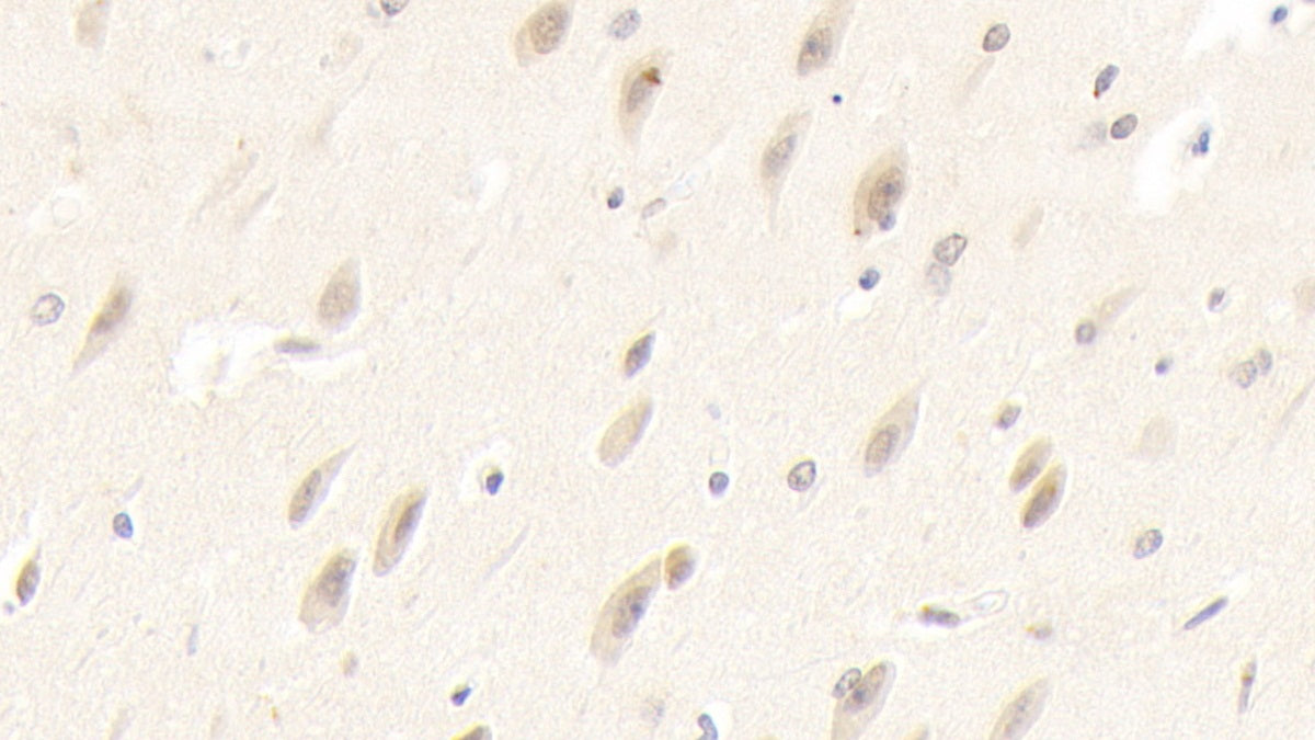 RCC1 And BTB Domain Containing Protein 2 (RCBTB2) Polyclonal Antibody - image 4