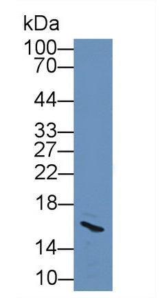 Prolactin Induced Protein (PIP) Polyclonal Antibody - image 3
