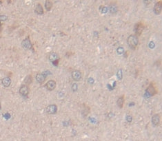 Prolactin Induced Protein (PIP) Polyclonal Antibody - image 4