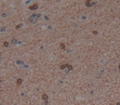 Period Circadian Protein 1 (PER1) Polyclonal Antibody - image 3