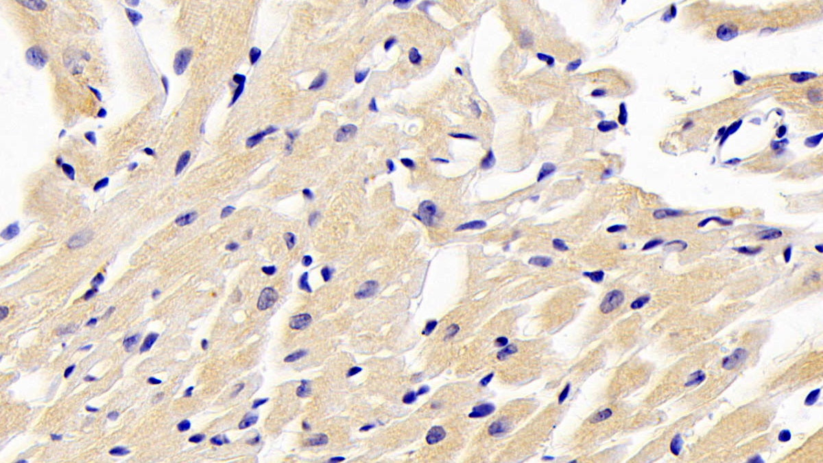 NUAK Family SNF1 Like Kinase 1 (NUAK1) Polyclonal Antibody - image 4