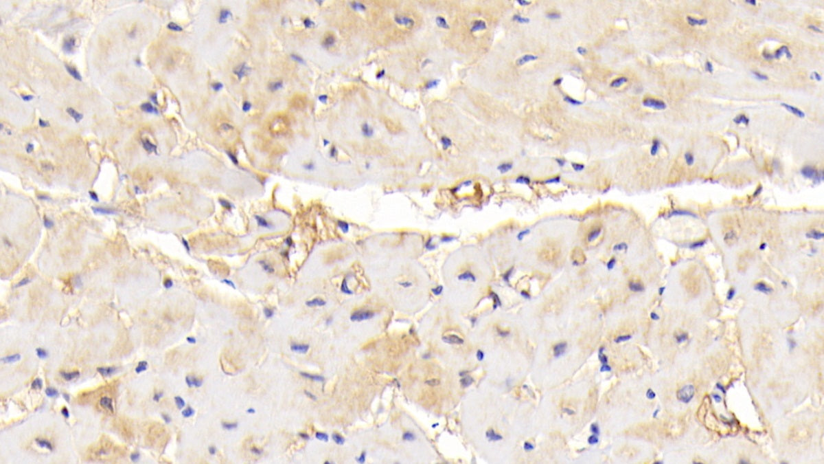 NUAK Family SNF1 Like Kinase 1 (NUAK1) Polyclonal Antibody - image 3