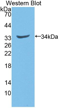 Western Blot; Sample: Rat Serum; ; Primary Ab: 1µg/ml Rabbit Anti-Rat NQO1 Antibody; Second Ab: 0.2µg/mL HRP-Linked Caprine Anti-Rabbit IgG Polyclonal Antibody;