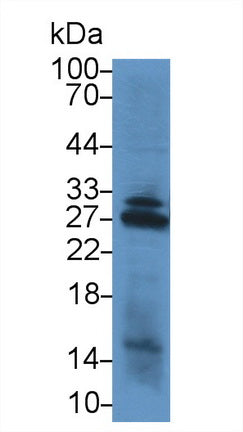 NADH Dehydrogenase, Quinone 1 (NQO1) Polyclonal Antibody - image 3