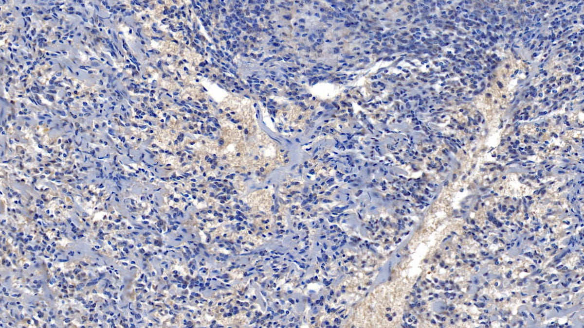 Nuclear Factor Of Activated T-Cells, Cytoplasmic 2 (NFATC2) Polyclonal Antibody - image 4