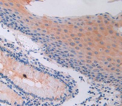 Wingless Type MMTV Integration Site Family, Member 4 (WNT4) Polyclonal Antibody - image 3