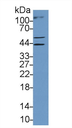 Western Blot; Sample: Recombinant protein.