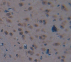 V-Myc Myelocytomatosis Viral Oncogene Homolog 1, Lung Carcinoma Derived (MYCL1) Polyclonal Antibody - image 4