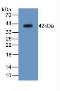 DAB staining on IHC-P; Samples: Mouse Liver Tissue; Primary Ab: 10µg/ml Rabbit Anti-Mouse AIMP1 Antibody Second Ab: 2µg/mL HRP-Linked Caprine Anti-Rabbit IgG Polyclonal Antibody