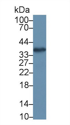 Western Blot; Sample: Recombinant protein.
