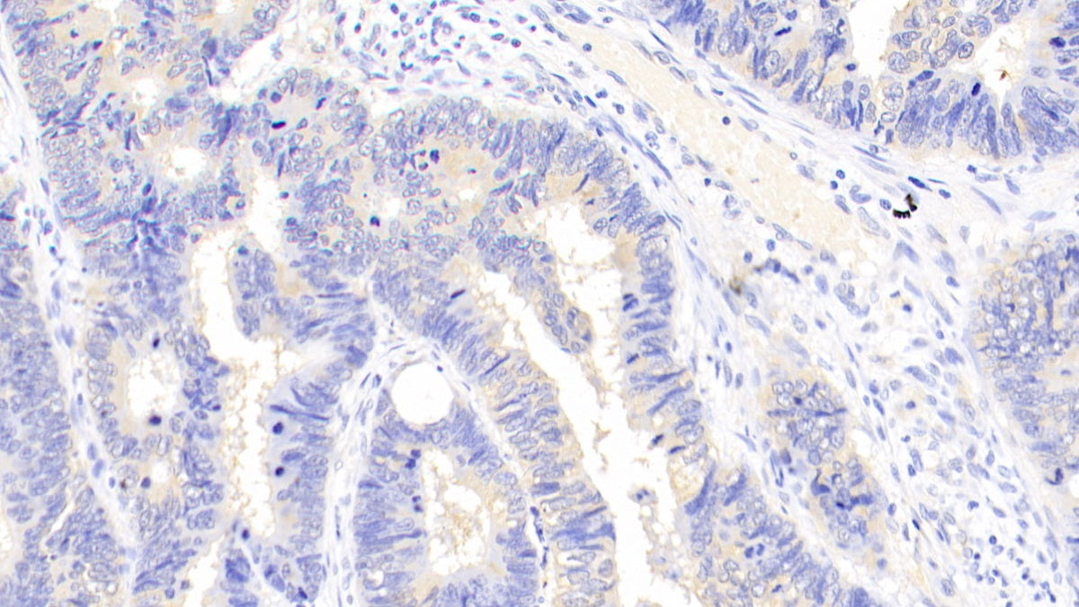 Aminoacyl tRNA Synthetase Complex Interacting Multifunctional Protein 1 (AIMP1) Polyclonal Antibody - image 4