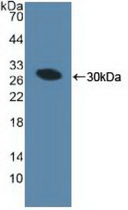 Mindbomb Homolog 1 (MIB1) Polyclonal Antibody - image 3