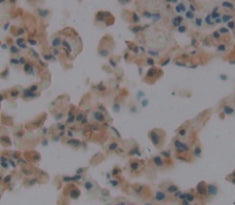 Mindbomb Homolog 1 (MIB1) Polyclonal Antibody - image 4