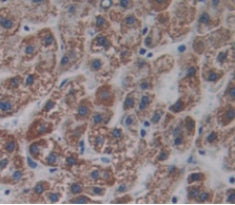 Leucine Rich Repeat Neuronal Protein 1 (LRRN1) Polyclonal Antibody - image 3