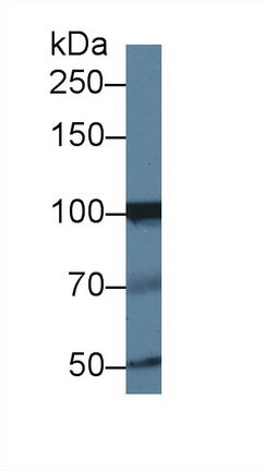 Western Blot; Sample: Recombinant protein.