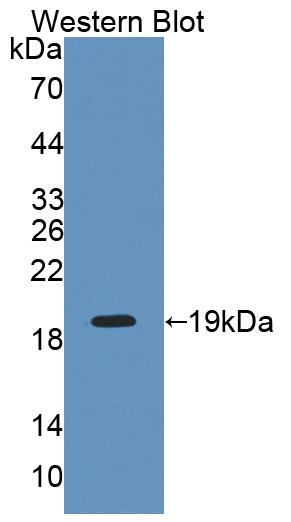 DAB staining on IHC-P; Samples: Human Lymph node Tissue; Primary Ab: 20μg/ml Rabbit Anti-Human INPP4A Antibody Second Ab: 2µg/mL HRP-Linked Caprine Anti-Rabbit IgG Polyclonal Antibody