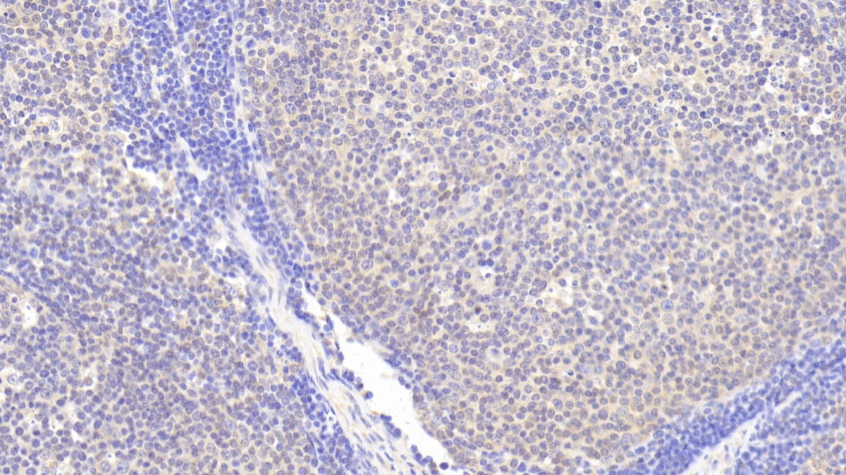 DAB staining on fromalin fixed paraffin- embedded brain tissue)