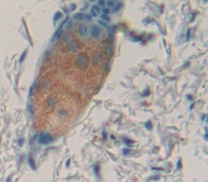 Interleukin 1 Family, Member 9 (IL1F9) Polyclonal Antibody - image 4