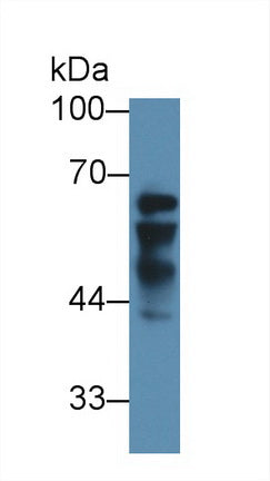Western Blot; Sample: Recombinant protein.