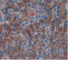 Interferon Induced Helicase C Domain Containing Protein 1 (IFIH1) Polyclonal Antibody - image 3