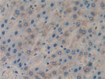 DAB staining on IHC-P; Samples: Rat Liver Tissue