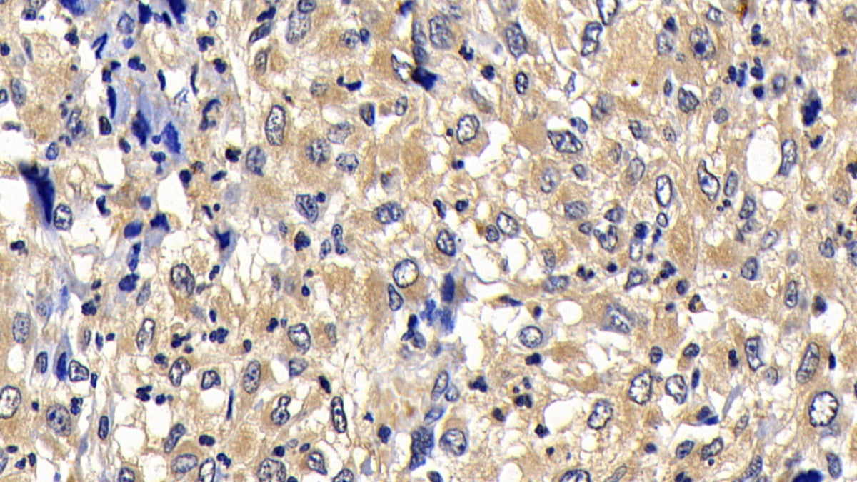 DABstainingonIHC-P.Samples:HumanTissue)