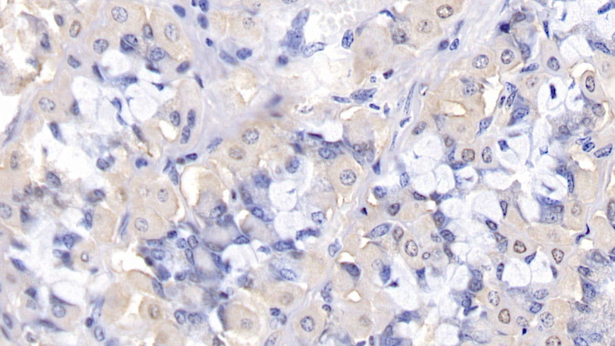 B-Cell CLL/Lymphoma 2 Like Protein 2 (Bcl2L2) Polyclonal Antibody - image 5
