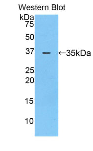Alpha-2-Glycoprotein 1, Zinc Binding (aZGP1) Polyclonal Antibody - image 2