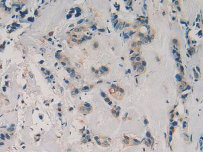 DAB staining on IHC-P; Samples：Human Kidney Tissue.