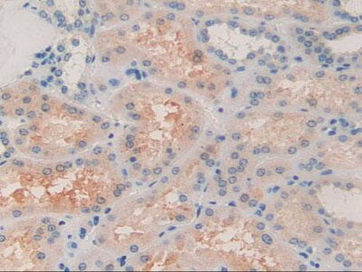 Alpha-2-Glycoprotein 1, Zinc Binding (aZGP1) Polyclonal Antibody - image 5