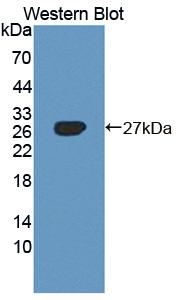 AXL Receptor Tyrosine Kinase (AXL) Polyclonal Antibody - image 2