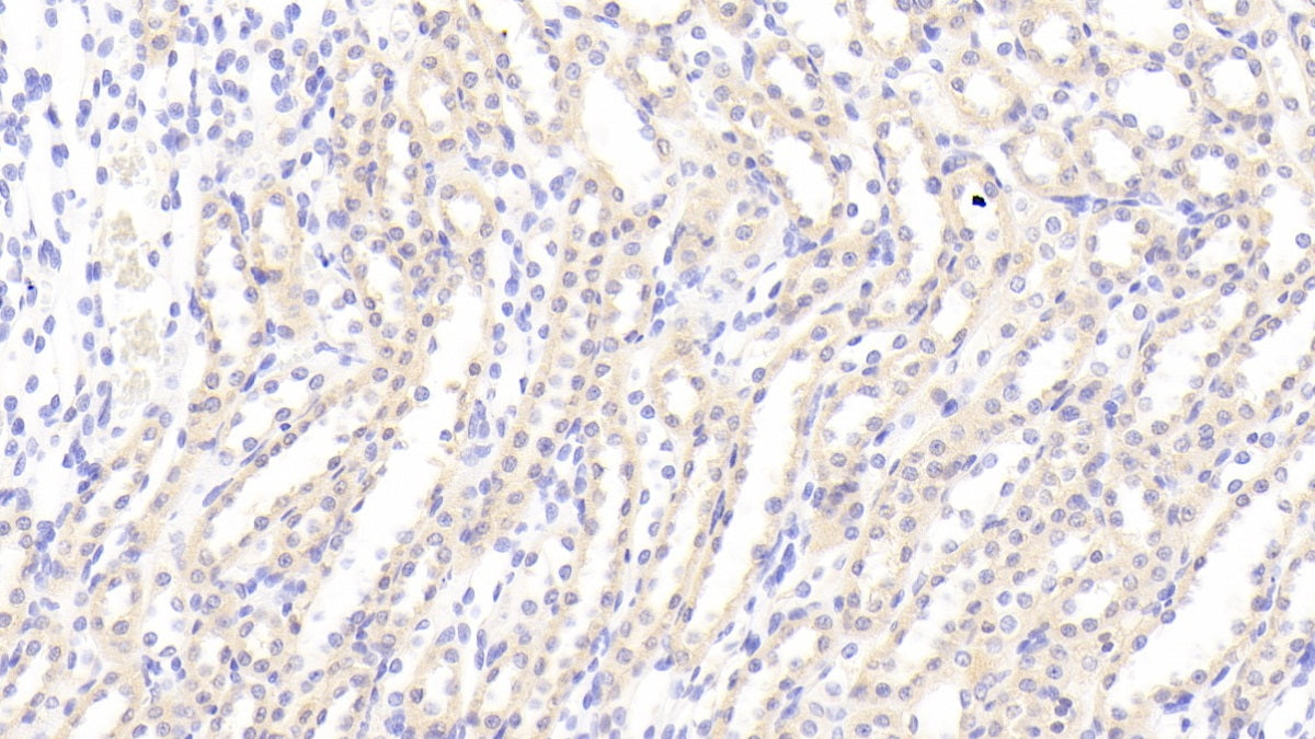 DABstainingonIHC-P.Samples:RatTissue)