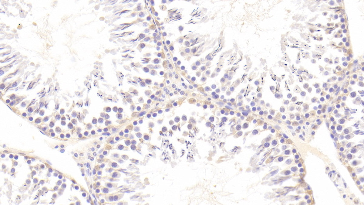 AXL Receptor Tyrosine Kinase (AXL) Polyclonal Antibody - image 4