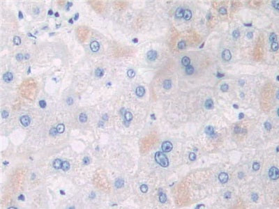 DAB staining on fromalin fixed paraffin- embedded Kidney tissue)