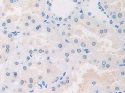 Adaptor Protein Phosphotyrosine Interaction PH Domain And leucine Zipper Containing Protein 1 (APPL1) Polyclonal Antibody - image 4